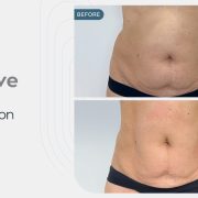 عيادة Medyed تجربة شاملة للعلاجات التجميلية والعافية المتقدمة